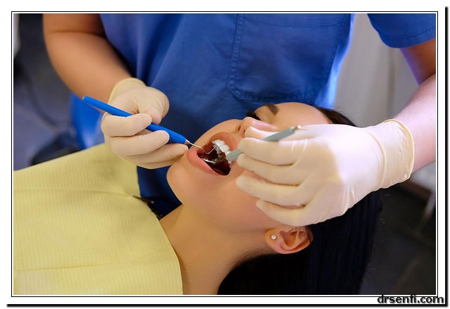کامپوزیت دندان در کلینیک دندانپزشکی دکتر صنفی