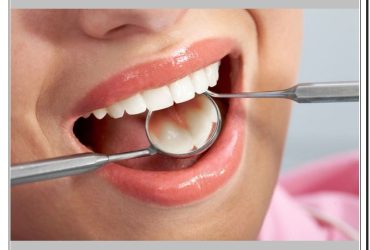عوارض کامپوزیت دندان در کلینیک دکتر صنفی