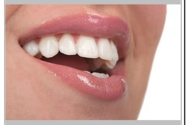 زیبایی دندان در کلینیک دندانپزشکی دکتر صنفی