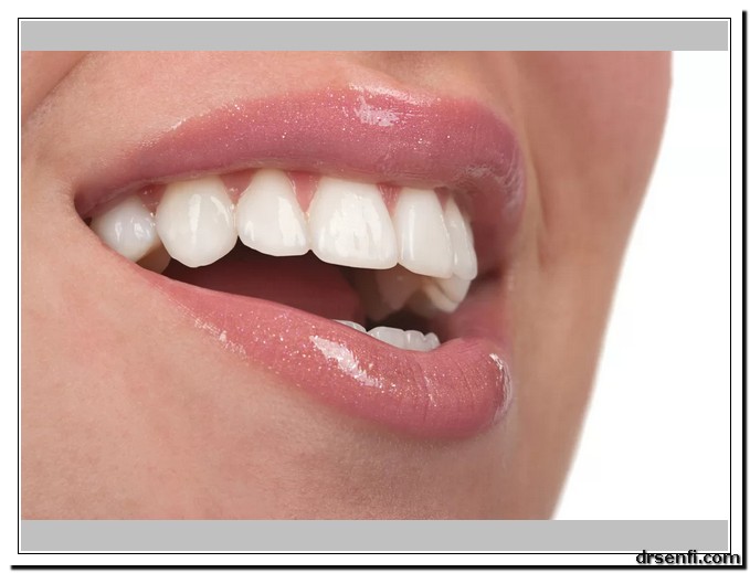زیبایی دندان در کلینیک دندانپزشکی دکتر صنفی