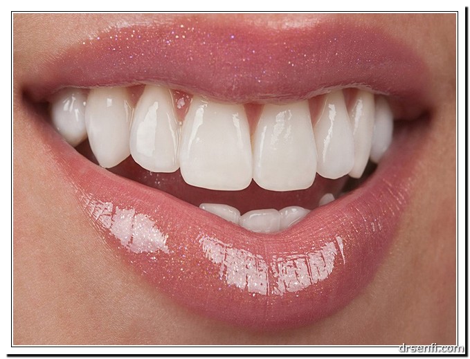 علت درد بعد از لمینت دندان چیست؟