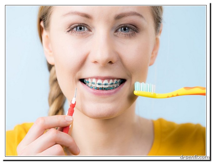 استفاده از ابزارهای مخصوص برای تمیز کردن دندان‌ها و دستگاه ارتودنسی