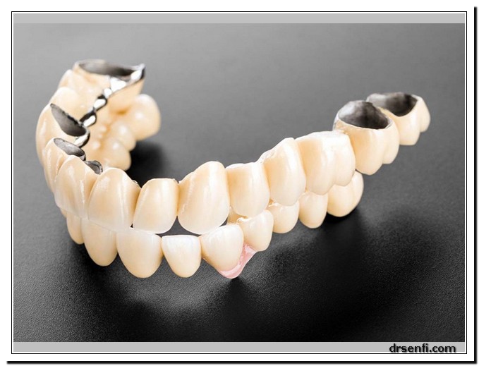 قیمت پروتز دندان در کلینیک دندانپزشکی دکتر صنفی
