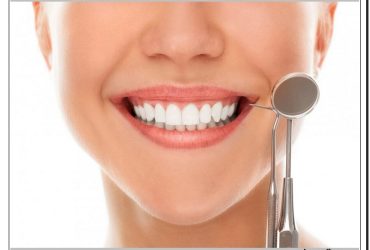 بهترین دکتر برای اصلاح طرح لبخند در کلینیک دندانپزشکی دکتر صنفی