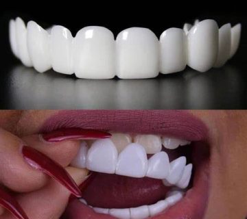 مزایا و معایب لمینت متحرک