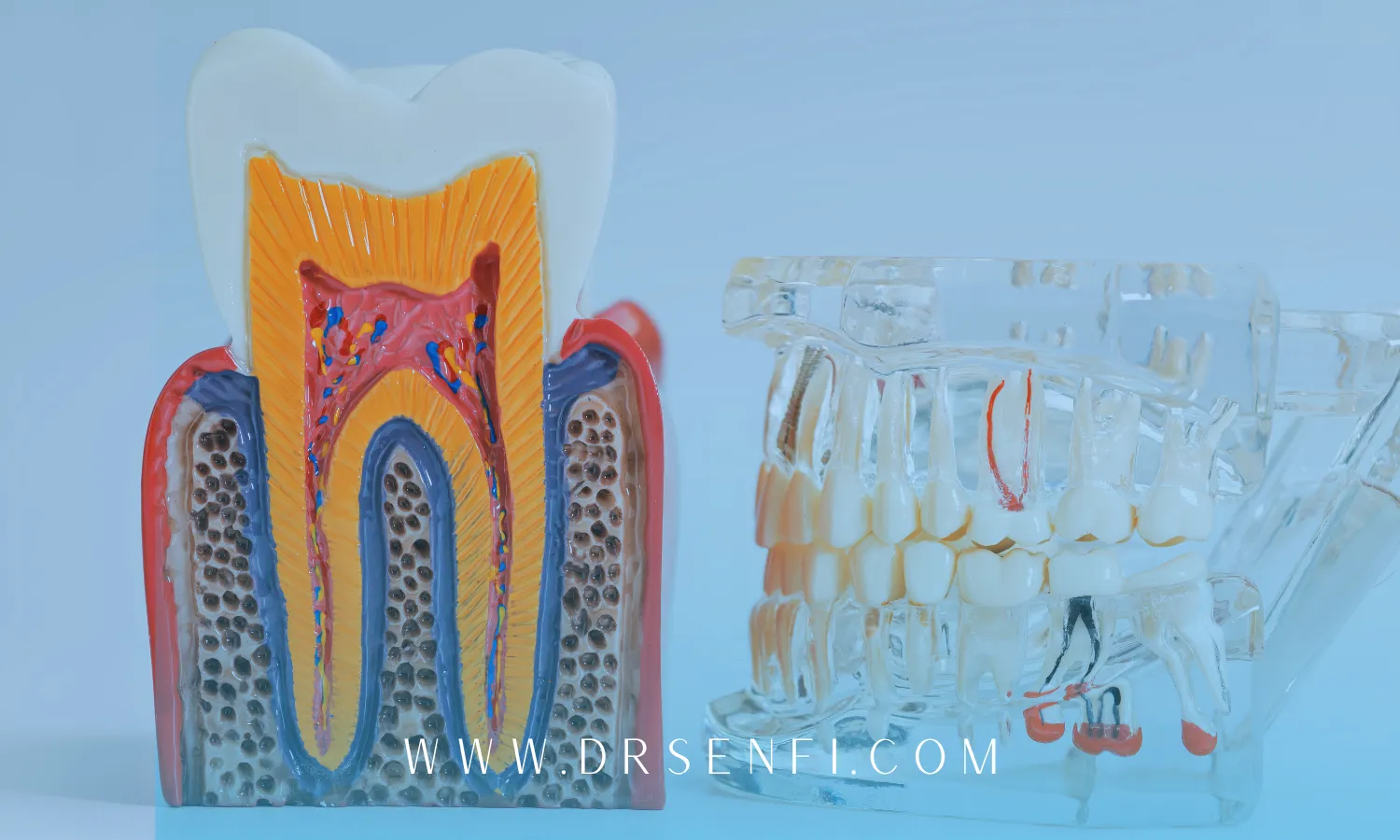 مشاوره پیوند استخوان قبل از ایمپلنت در تهران